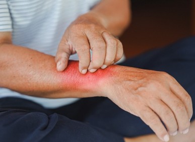 Exames de sangue e alergias