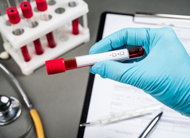 Importância dos exames de sangue