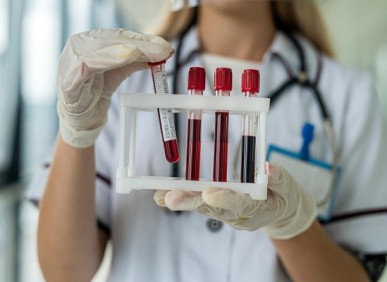 Preparação para exames de sangue